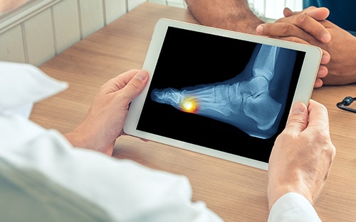 Metatarsalgia diagnosis and treatment often depend on xray images