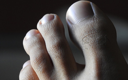 Improving foot health requires cleanliness and grooming