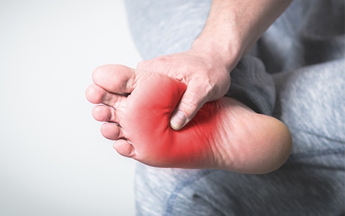 pain in arch of foot