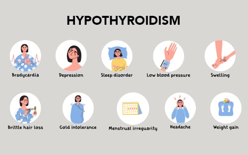 symptoms of hypothyroidism - common signs like fatigue and dry skin