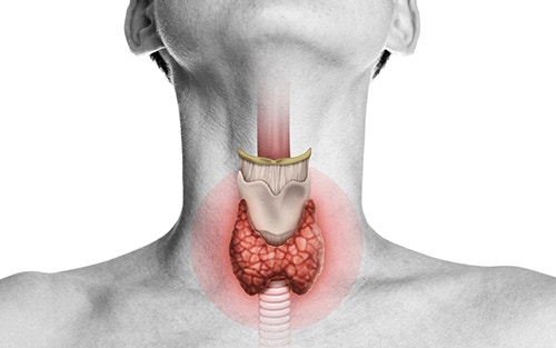 thyroid disease